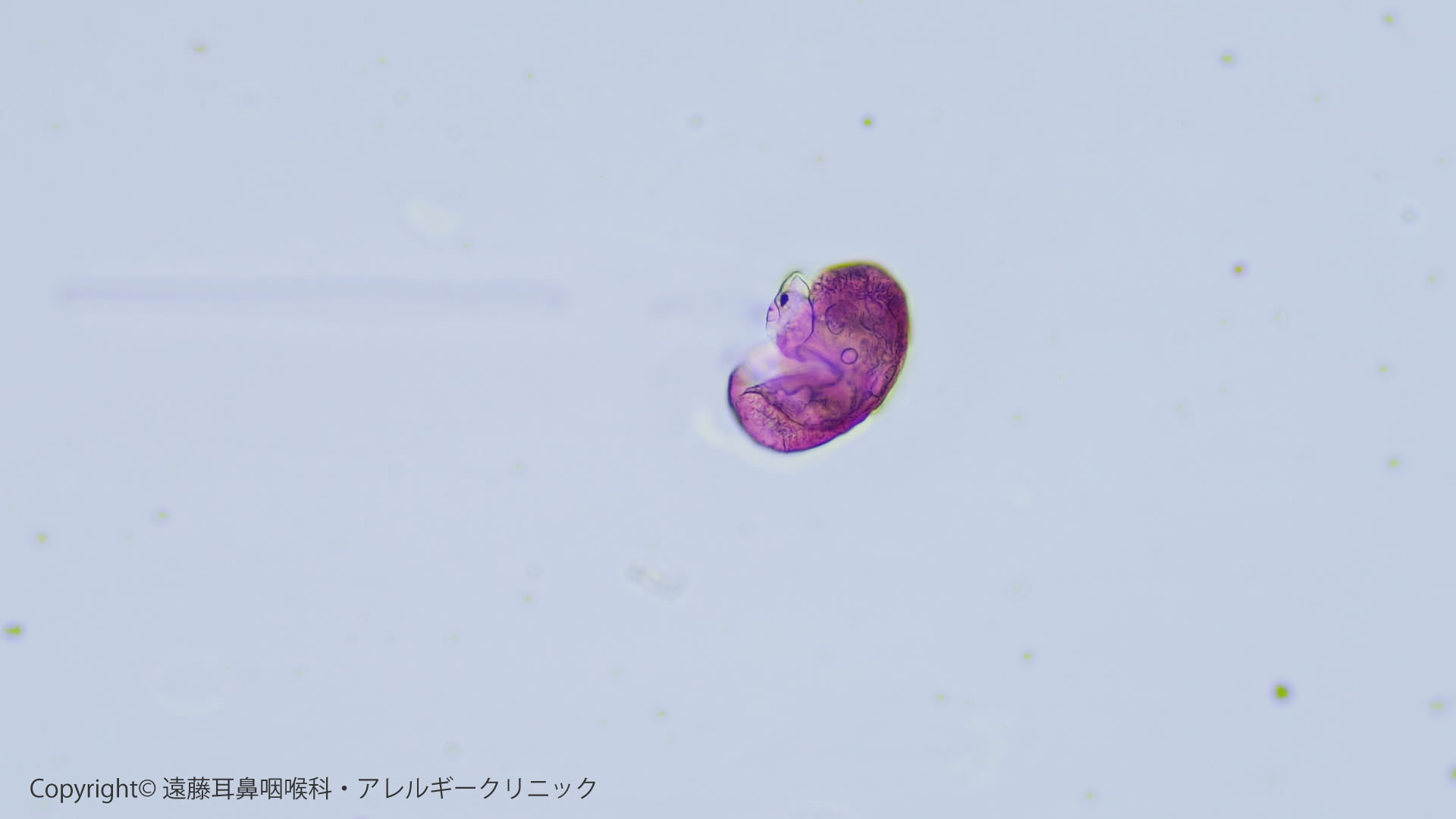 年3月15日花粉情報 遠藤耳鼻咽喉科 アレルギークリニック